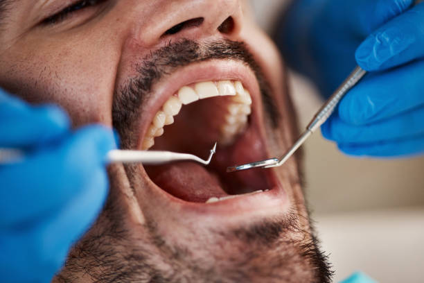 Reliable CA Emergency Dental Service Solutions